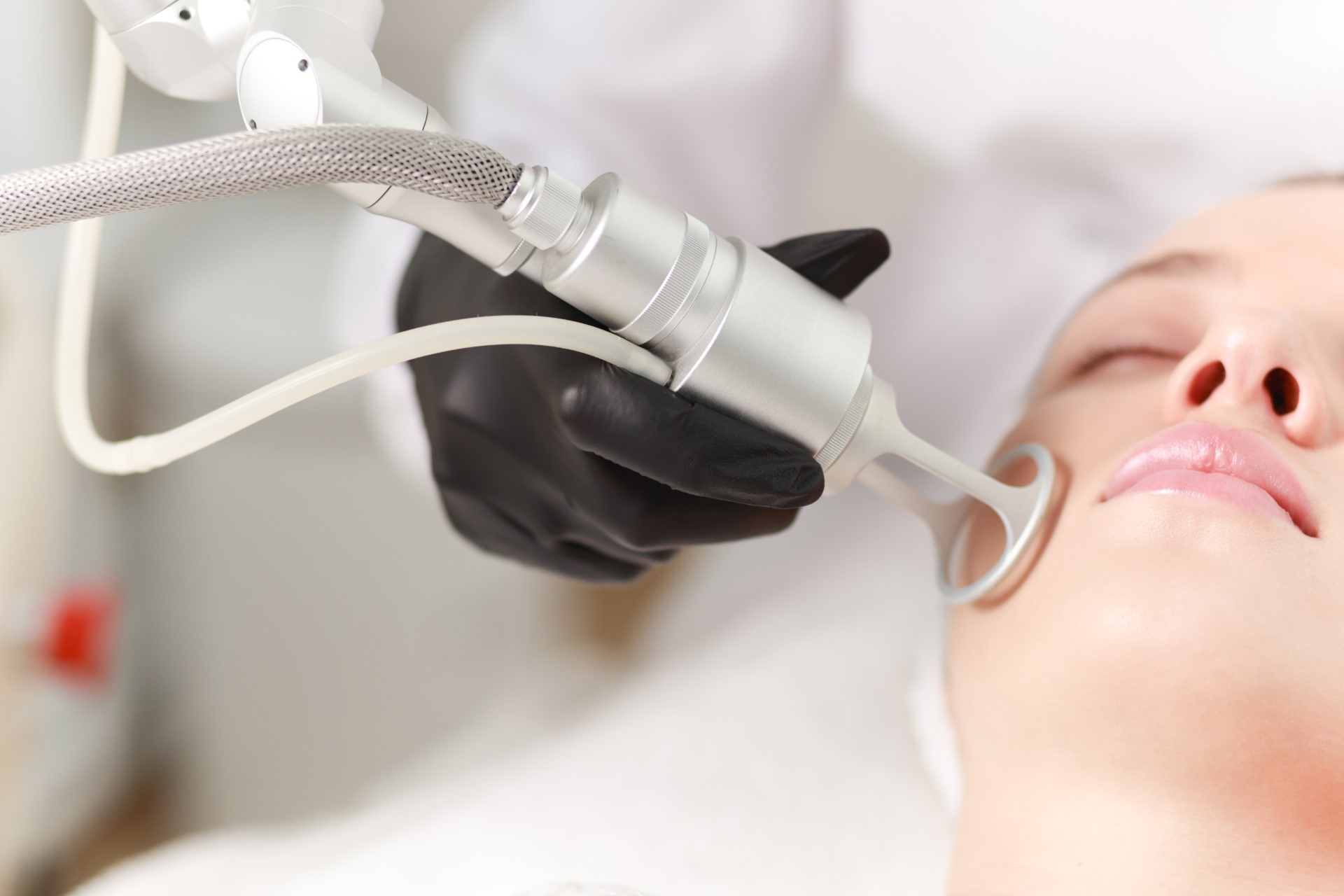 CO2 carbon dioxide laser resurfacing procedure.